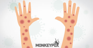 The Latest Monkeypox Updates